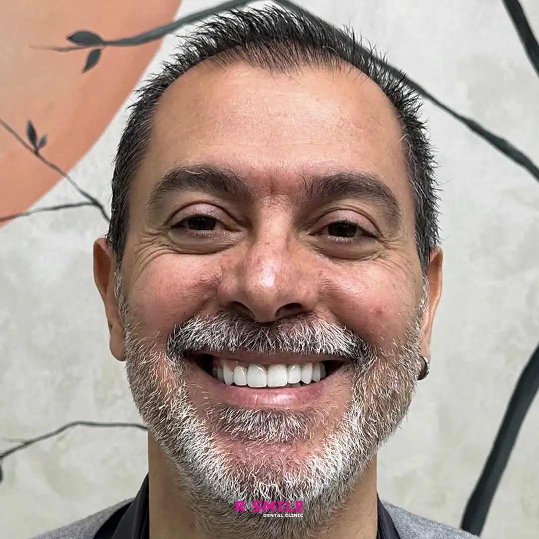 Gülüş estetiği işlemi sonrası R Smile Dental Clinic hasta görünümü
