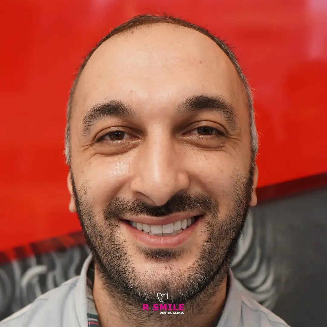 R Smile Dental Clinic ortodonti tedavi sonucu hasta gülüşü